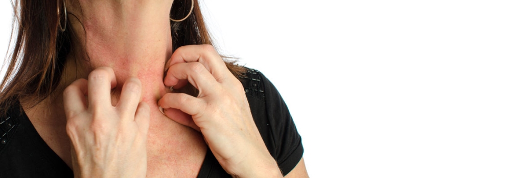 幹燥的空氣如何影響哔咔漫画免费观看入口官网的皮膚